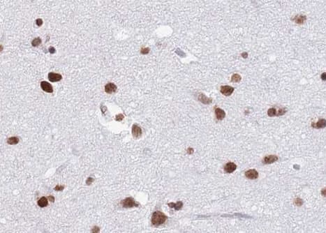 HNRNPC / HNRNP C Antibody