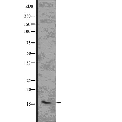 CENPA / CENP-A Antibody