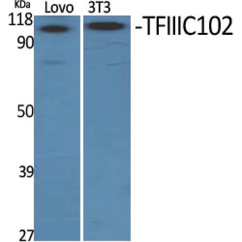 Polyclonal Rabbit anti-Human GTF3C3 Antibody (70-150 aa, N-terminal, IHC, WB)