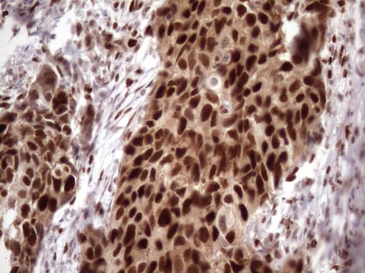 Monoclonal Mouse anti-Human BTEB / KLF9 Antibody (clone OTI8A11, IHC, WB)