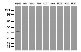 HP / Haptoglobin Antibody (clone UMAB10)
