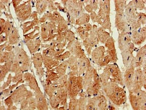 KIAA0652 / ATG13 Antibody