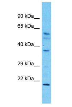 Polyclonal Rabbit anti-Human DYNC2LI1 / D2LIC Antibody (aa52-101, WB)
