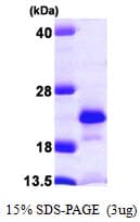 Human NUDT2 Protein (Recombinant His)
