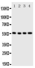 SLC2A5 / GLUT5 Antibody (aa481-501)