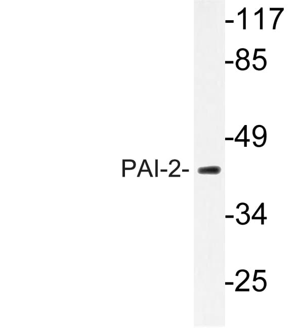 SERPINB2 / PAI-2 Antibody (aa258-307)