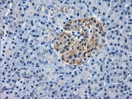 Monoclonal Mouse anti-Human AKR1A1 Antibody (clone OTI4G2, IHC, WB)
