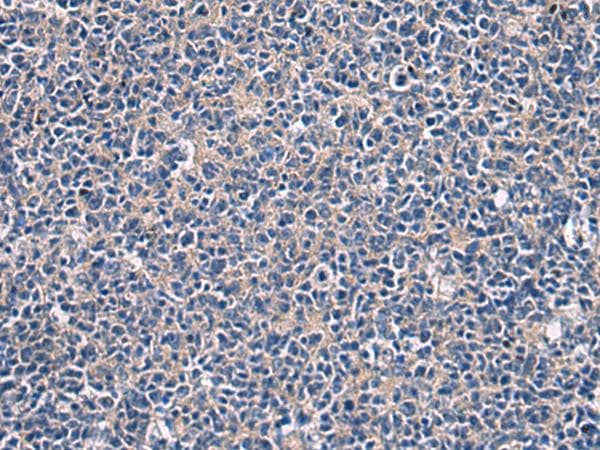 LAMP3 / CD208 Antibody