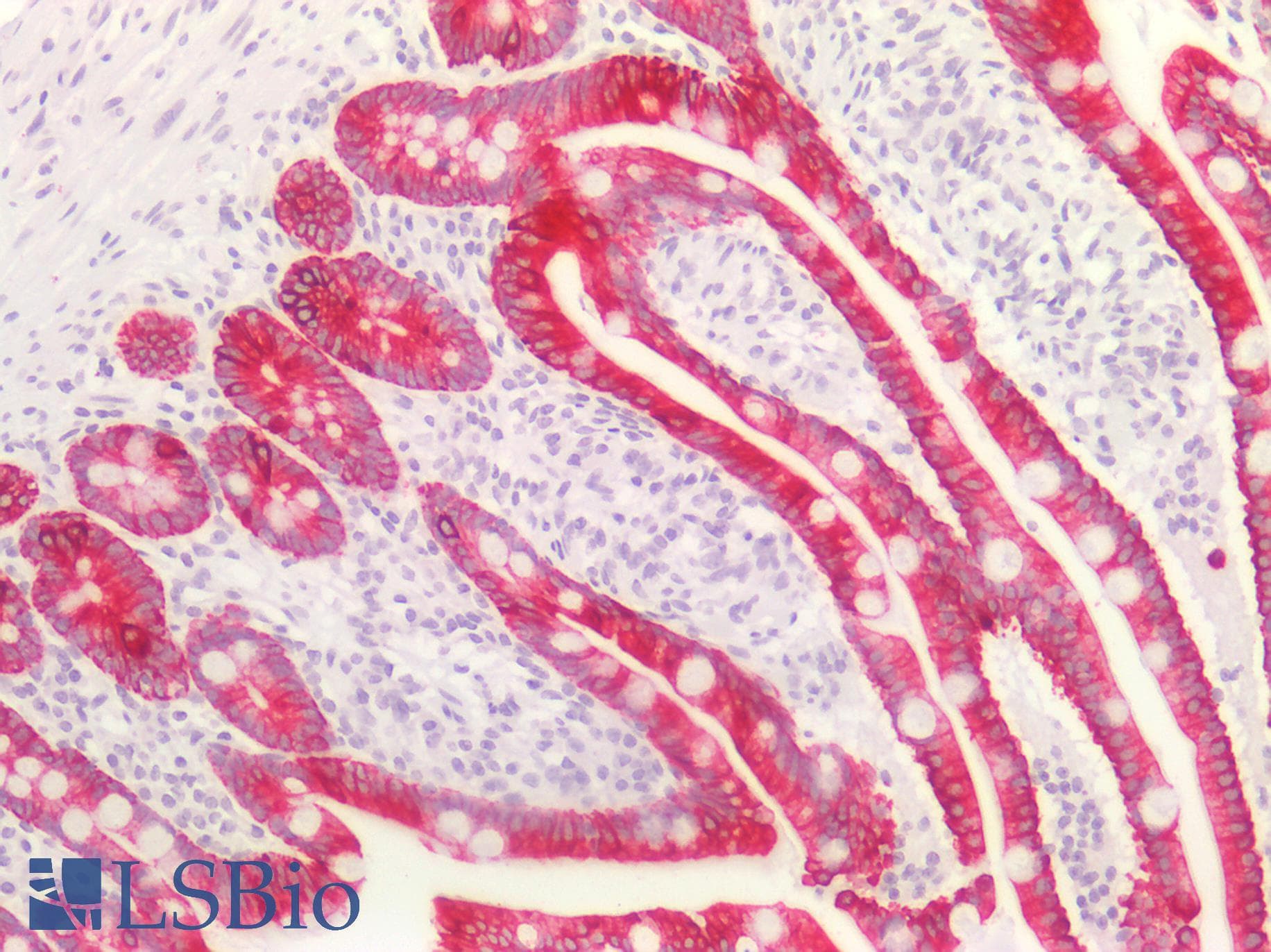 PathPlus™ Monoclonal Mouse anti-Human Basic Cytokeratin AE3 Antibody (clone AE-3, Concentrated, IHC, WB)
