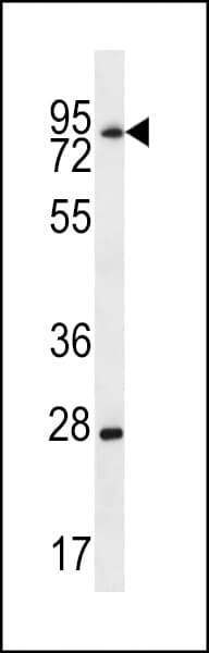 IHC-plus™ LIMD1 Antibody (aa438-467)