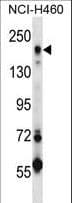 Polyclonal Rabbit anti-Human MRC2 / Endo180 Antibody (aa798-827, WB)