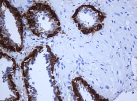 KRT5 / CK5 / Cytokeratin 5 Antibody (Conserved Region, clone OTI1C7, Carrier-free)