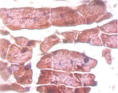 TTN / Titin Antibody (aa5398-5604)