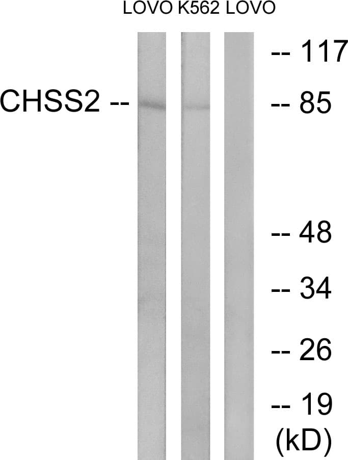 IHC-plus™ Polyclonal Rabbit anti-Human CHPF / CHSY2 Antibody (aa631-680, IHC, IF, WB)