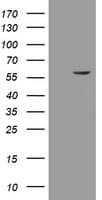 ESRRG / ERR Gamma Antibody (aa24-263, clone OTI5G8)