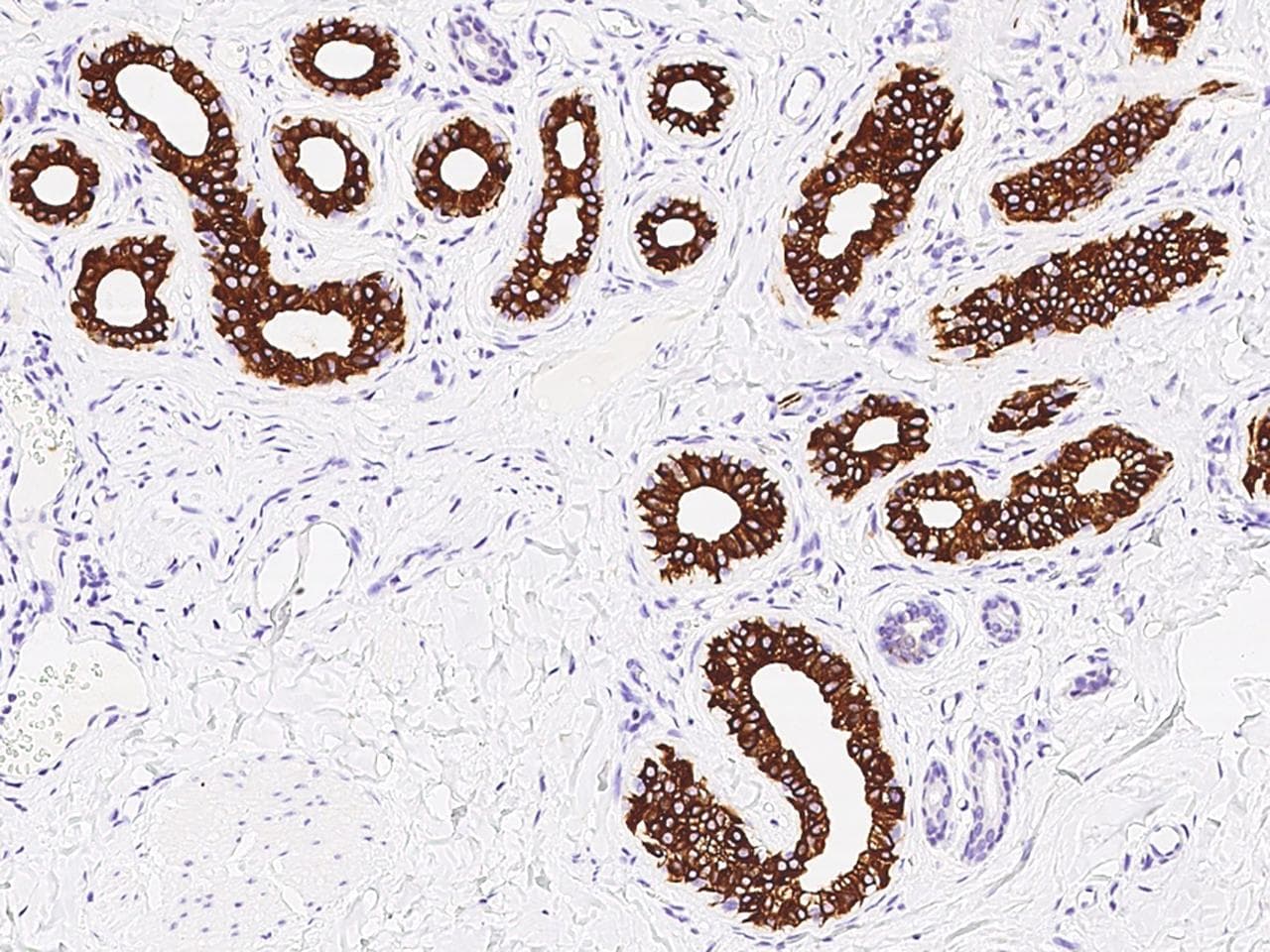 Polyclonal Rabbit anti-Human KRT18 / CK18 / Cytokeratin 18 Antibody (Preservative Free, IHC, WB)
