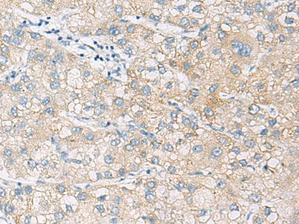 ARA70 / NCOA4 Antibody