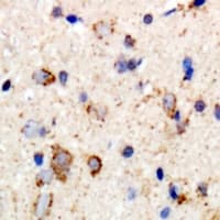 GABRB2 Antibody