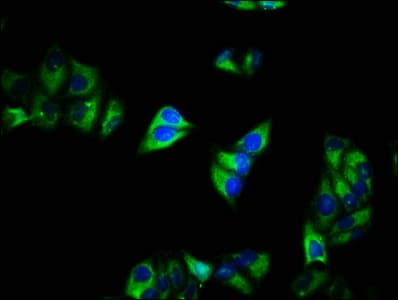CACNA2D1 Antibody (aa528-668)