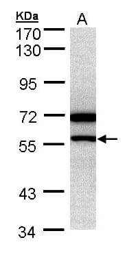 NR0B1 / DAX1 Antibody (aa96-406)