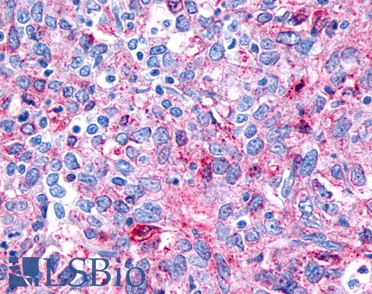 PathPlus™ FZD8 / Frizzled 8 Antibody (N-Terminus)
