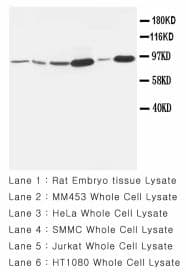 MMP9 / Gelatinase B Antibody (aa689-705)