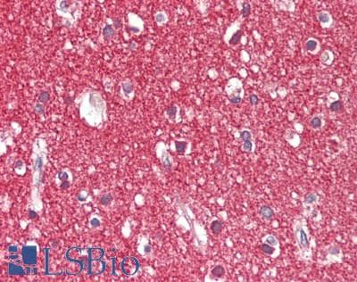 Polyclonal Rabbit anti-Human ICAM5 / ICAM-5 Antibody (aa874-924, IHC, WB)