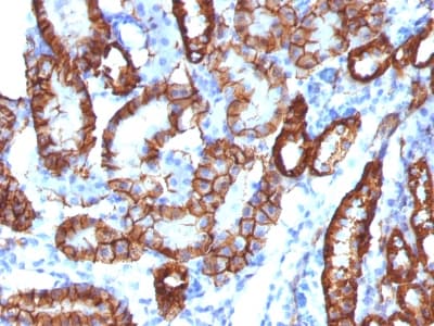 CDH16 / Cadherin 16 Antibody (clone CDH16/1532R, Azide-free, Carrier-free)