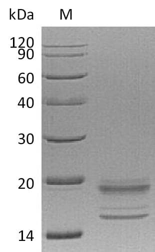 Human IL17A+IL17F Protein (Recombinant 6His, C-terminus)