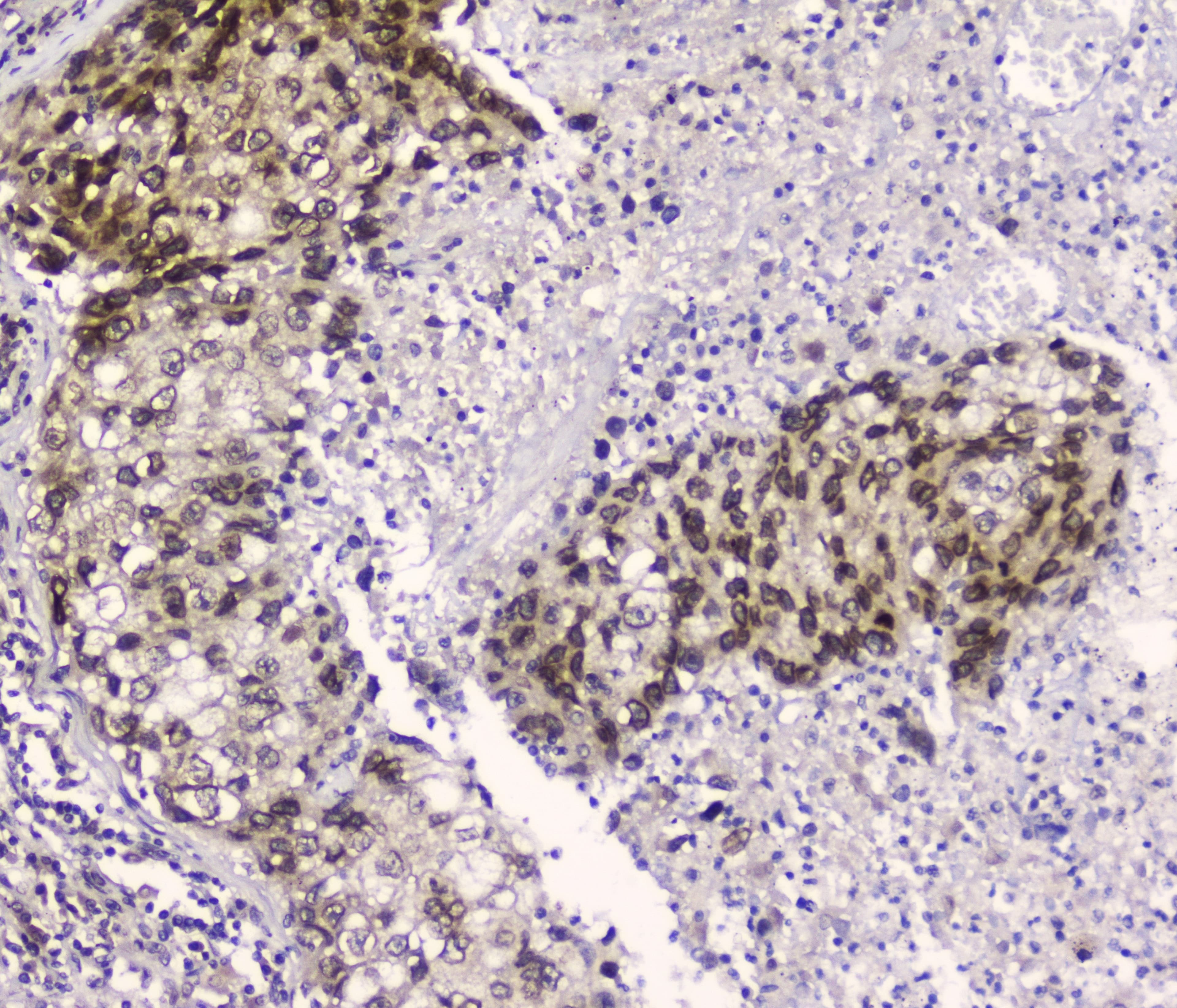 XPO1 / CRM1 Antibody