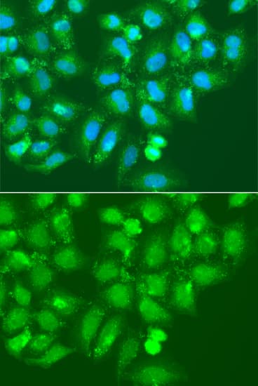AMY2B Antibody