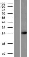 PTMS / Parathymosin Protein (Over-Expression Lysate Myc-DDK (Flag))