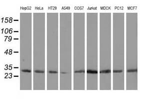 CAPZA1 / CAPZ Alpha 1 Antibody (clone OTI7C8, Carrier-free)