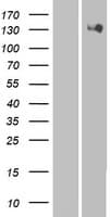 HIPK2 Protein (Over-Expression Lysate Myc-DDK (Flag))