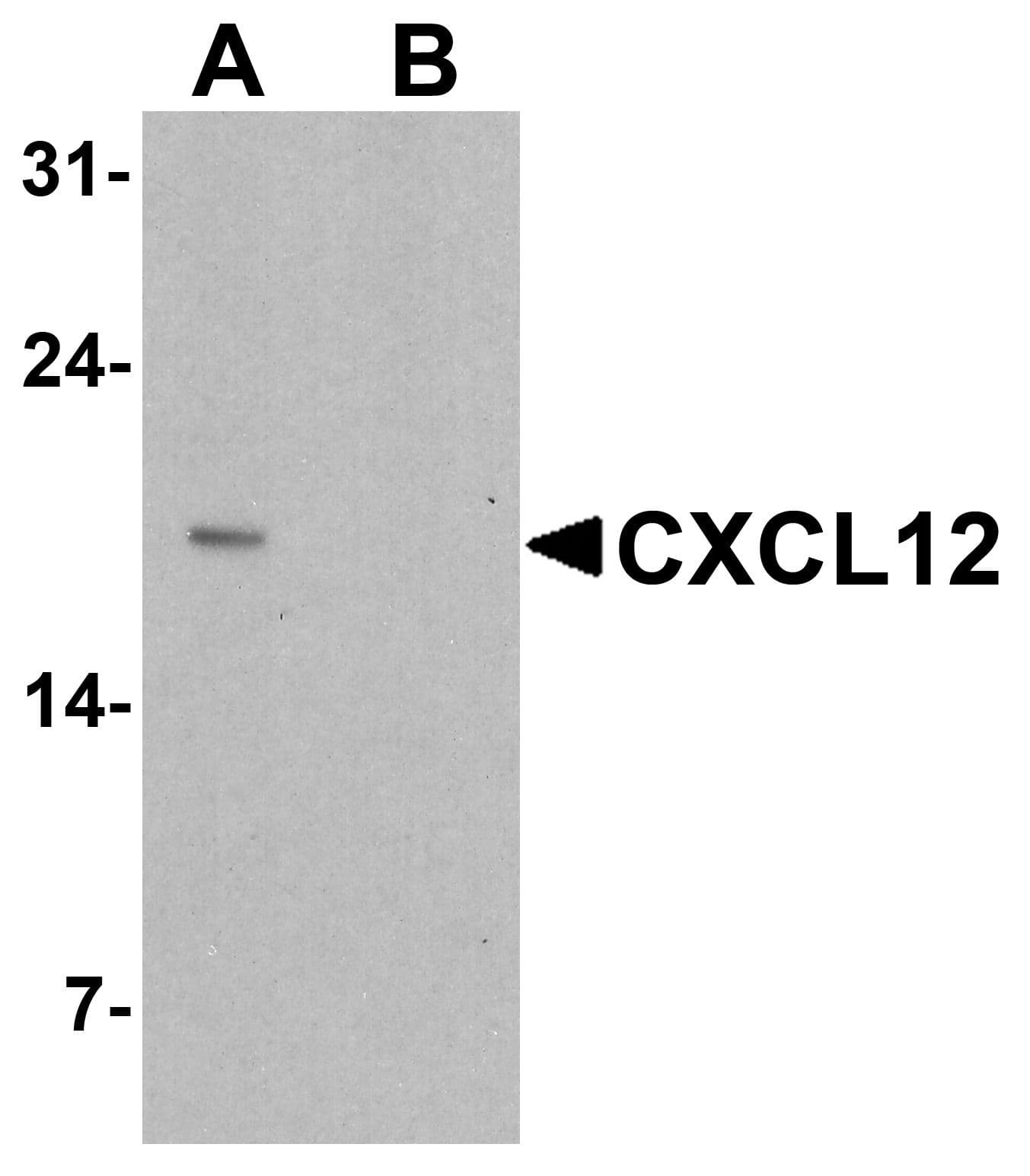Polyclonal Rabbit anti-Human SDF1 / CXCL12 Antibody (WB)