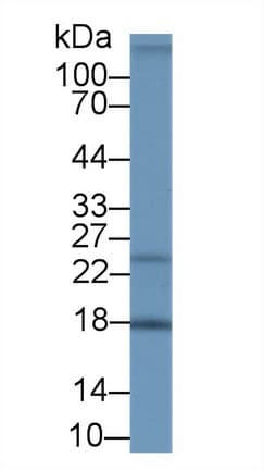 NENF / Neudesin Antibody (aa32-172)