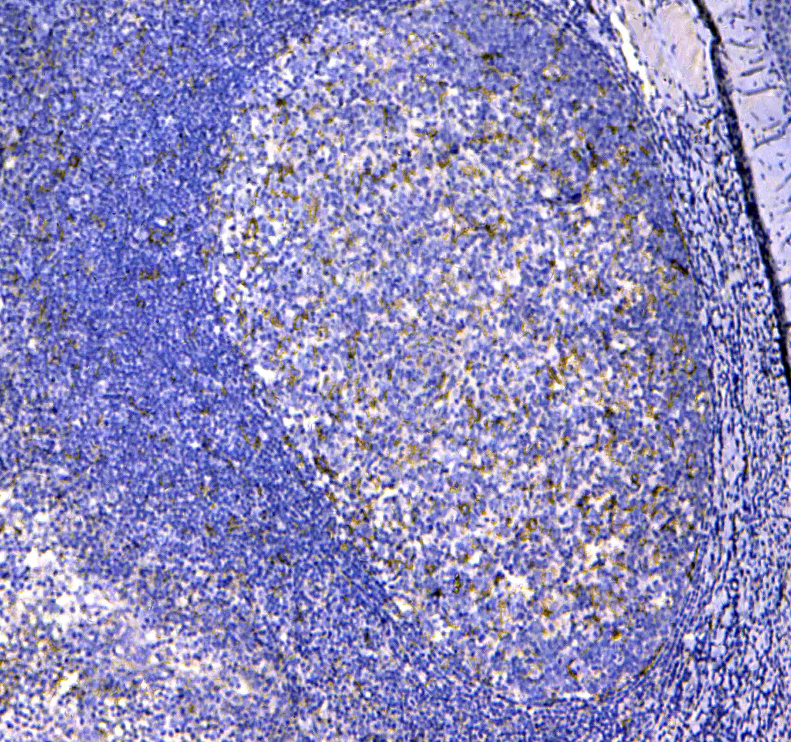 Polyclonal Rabbit anti-Human ITGAX / CD11c Antibody (IHC, WB)