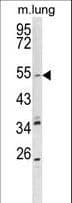 Polyclonal Rabbit anti-Human KCNQ1 / KVLQT1 Antibody (aa513-540, IHC, WB)