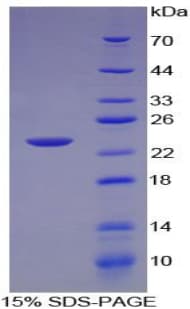 Human LTA / TNF Beta Protein (Recombinant His-T7)