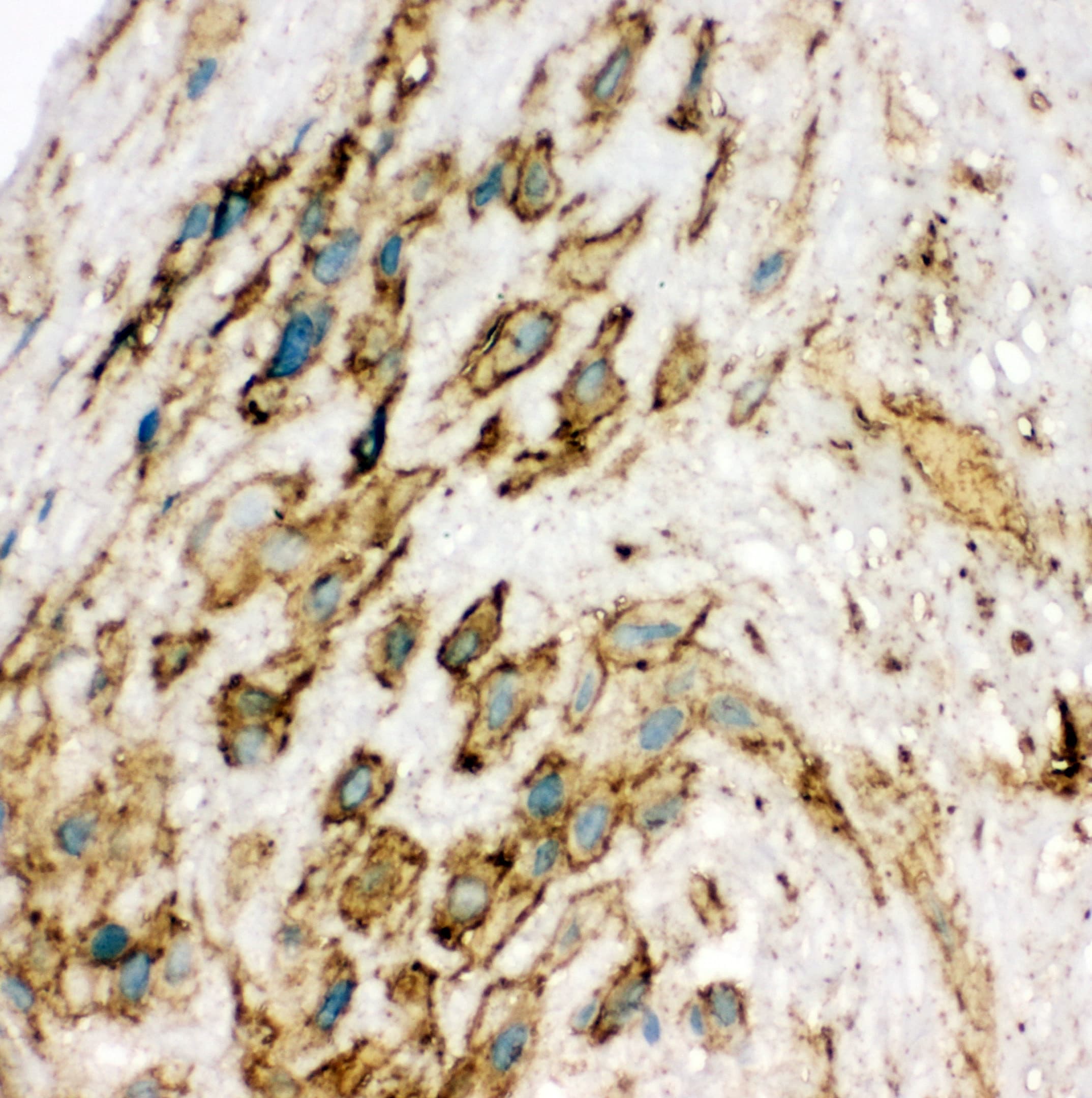 KDR / VEGFR2 / FLK1 Antibody (aa454-469)