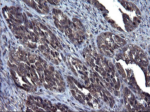TXNDC5 / ERP46 Antibody (clone OTI2E6)