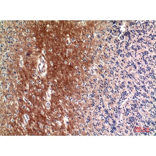 Complement C4a+b Antibody (721-770 aa, Internal)