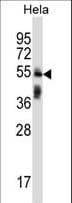 TRIM38 Antibody (aa423-451)