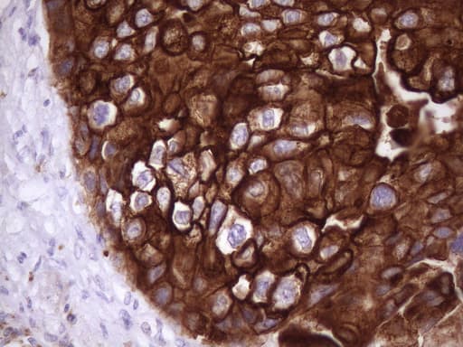 KRT16 / CK16 / Cytokeratin 16 Antibody (clone OTI1G5, Carrier-free)