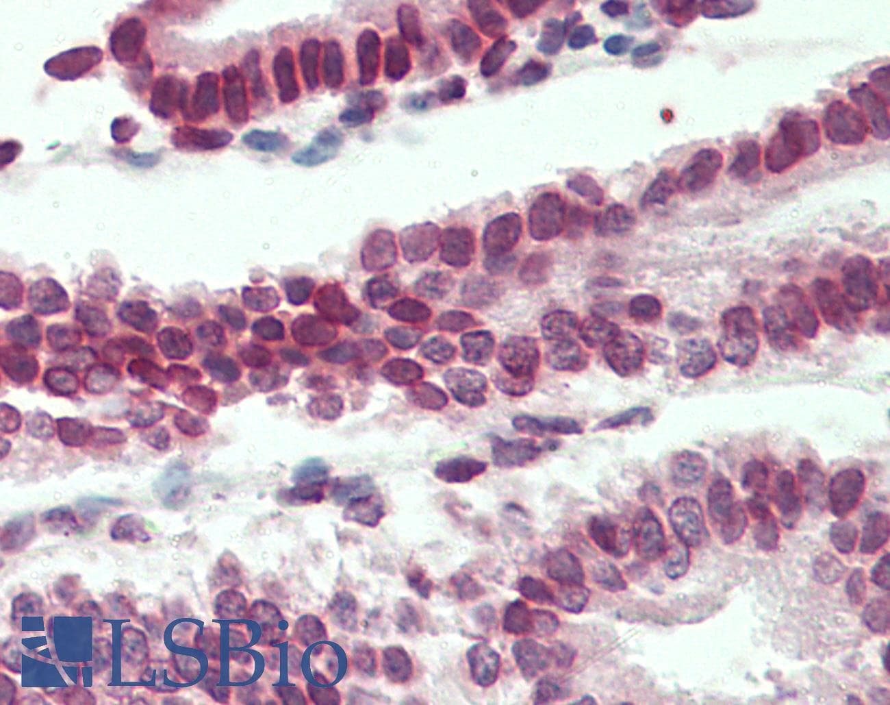 IHC-plus™ Polyclonal Goat anti-Human LMNB1 / Lamin B1 Antibody (aa526-537, IHC, WB)