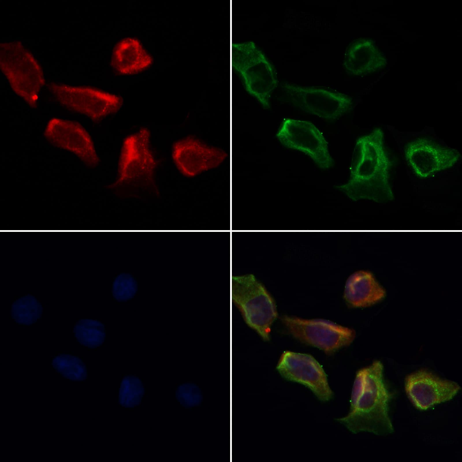 PPP3CB Antibody