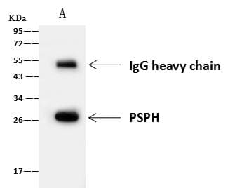 PSPH Antibody (Preservative Free)