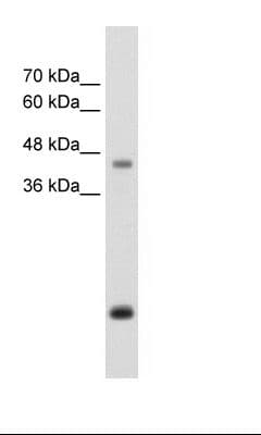 ASPN / Asporin Antibody (aa250-299)
