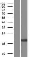 TRAPPC1 / MUM2 Protein (Over-Expression Lysate Myc-DDK (Flag))