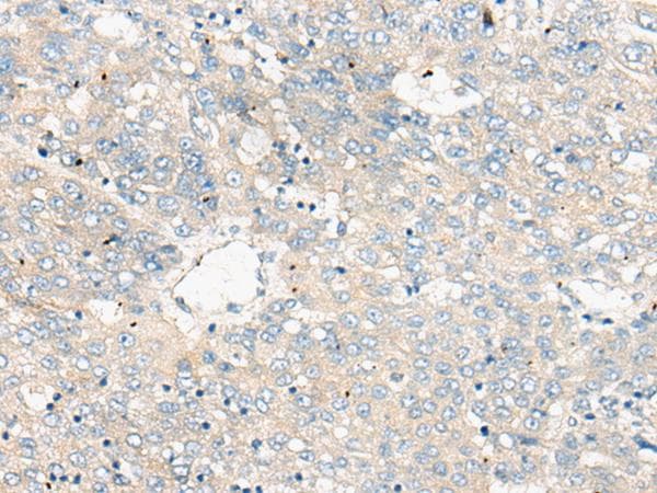 ZNF449 Antibody